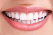 Teeth Whitening
